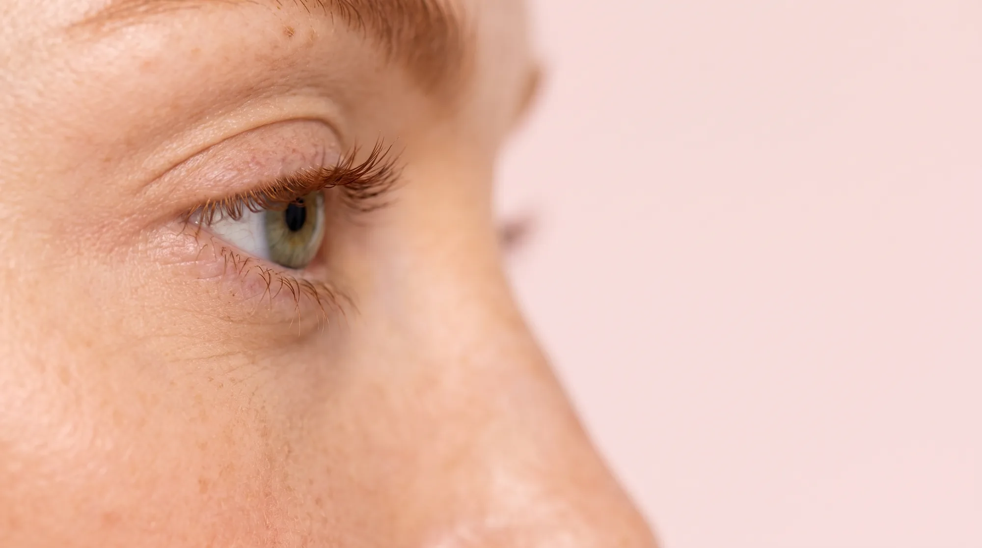 Ángulo externo del ojo con líneas más alisadas · Contorno de Ojos Kalipè